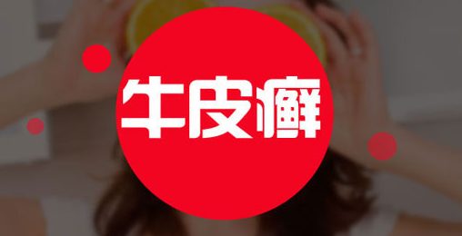 郑州治牛皮癣专科